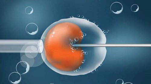 三代试管婴儿囊胚培养技术简介研究根系发育的重要技术